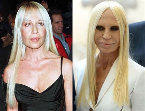 donatella versace awards|Donatella Versace before and after surgery.